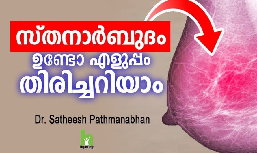 ഇതാണ് സ്ഥാനാർബുദത്തിന്റെ വിവിധ ലക്ഷണങ്ങൾ. ഈ ലക്ഷണങ്ങളെ ഒരിക്കലും ചെറുതായി കാണരുത്. | Breast Cancer Malayalam