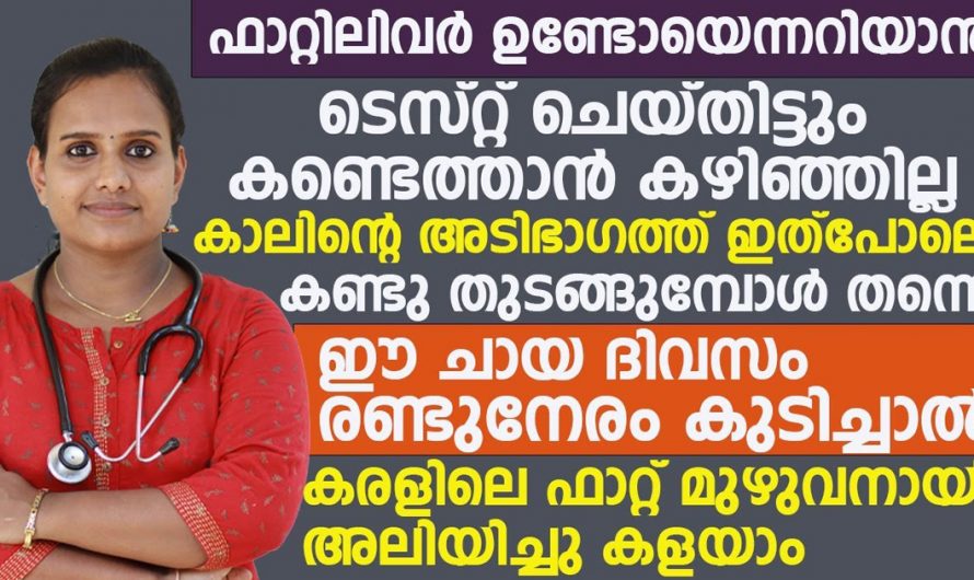 കരളിൽ അടിഞ്ഞുകൂടിയിരിക്കുന്ന ഫാറ്റ് കുറയ്ക്കാൻ ഇതുപോലെ ചായ ഉണ്ടാക്കി കുടിച്ചാൽ മതി. | Remove Fatty liver Malayalam