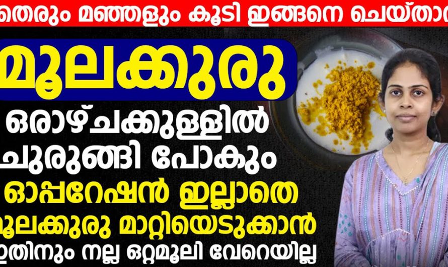 കാലങ്ങളായി മൂലക്കുരു പ്രശ്നമായി നടക്കുന്നവർ ഇത് കാണാതെ പോകരുത്. ഈ ഒറ്റമൂലി കഴിച്ചു നോക്കൂ. | Piles Treatment at Home