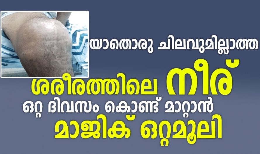 യാതൊരു ചെലവുമില്ലാതെ ശരീരത്തിലെ നീര് ഒറ്റ ദിവസം കൊണ്ട് മാറ്റാൻ ഇതാ മാജിക് ഒറ്റമൂലി. | Prevent body fluids Tip