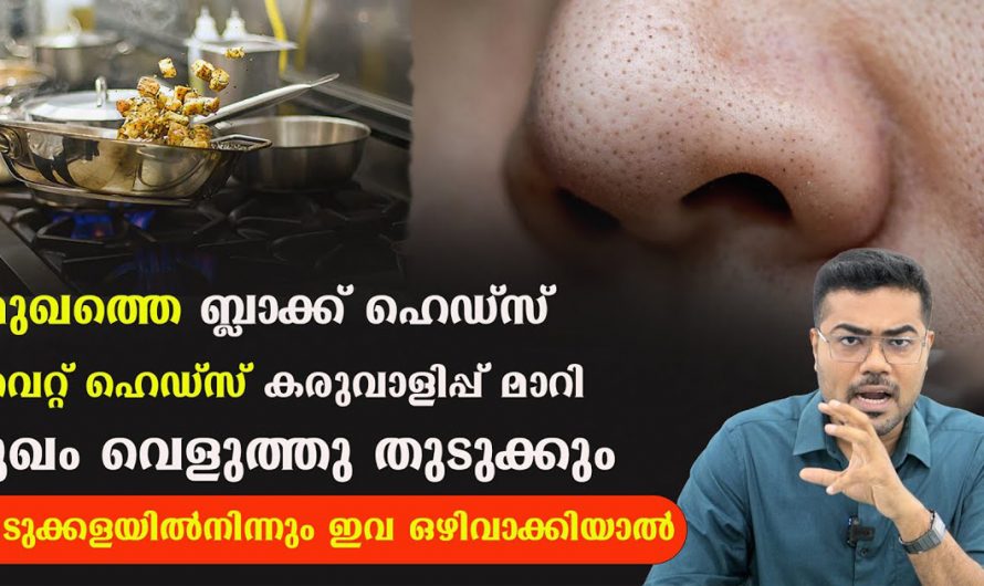 മുഖത്തെ ബ്ലാക്ക് ഹെഡ്സിനും കരുവാളിപ്പിനും വീട്ടിൽ തന്നെ ഇനി പരിഹാരം. | Remove Black heads White Heads