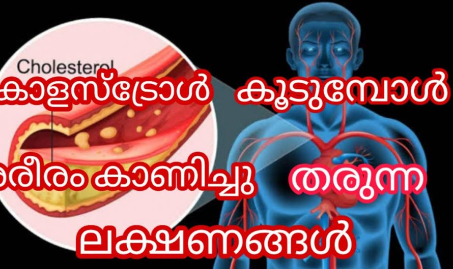 ഈ ലക്ഷണങ്ങൾ കണ്ടാൽ നിങ്ങളുടെ ശരീരത്തിൽ കൊളസ്ട്രോൾ കൂടുതലാണ്. ഉടനെ ചികിത്സ നടത്തു. | High Cholesterol Symptoms Malayalam