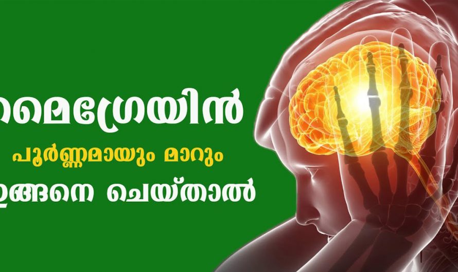 മൈഗ്രൈൻ പൂർണ്ണമായും മാറ്റിയെടുക്കാം. ഇതാ കണ്ടു നോക്കൂ. | Migraines Will Go Away Completely