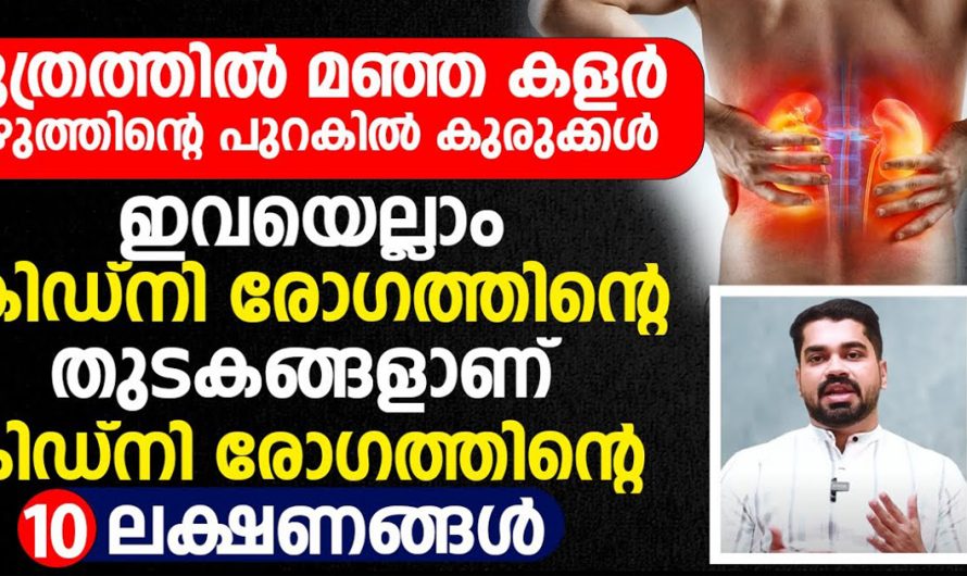 ഈ ലക്ഷണങ്ങളിലൂടെ കണ്ടുപിടിക്കാം നിങ്ങൾക്ക് കിഡ്നി രോഗം ഉണ്ടോ ഇല്ലയോ എന്ന്. | Prevent Kidney Problems