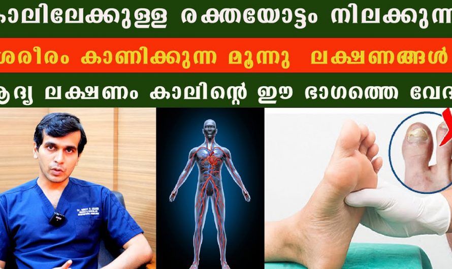 നിങ്ങളുടെ കാലിലേക്ക് രക്തയോട്ടം കുറവാണോ? ഈ അപായ ലക്ഷണങ്ങൾ അവഗണിക്കരുത്. | peripheral artery disease