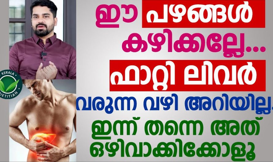 ഫാറ്റി ലിവർ കുറയ്ക്കാൻ ഈ ഒരു മാർഗമേയുള്ളൂ. ഇതറിയാതിരുന്നാൽ വലിയ നഷ്ടമായിരിക്കും. | Fatty Liver Malayalam