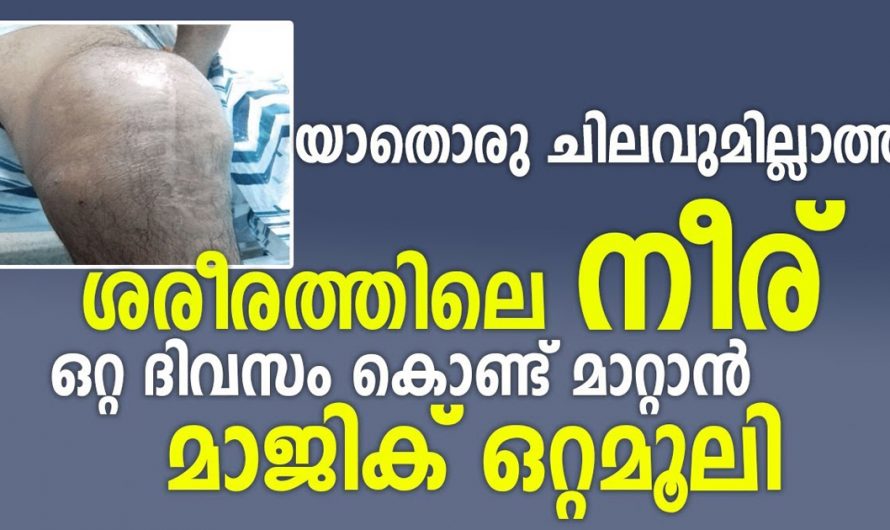 ശരീരത്തിലെ നീര് ഇനി ഇതുപോലെ ചെയ്താൽ ഉടനെ മാറ്റിയെടുക്കാം. ഇതാ കണ്ടു നോക്കൂ. | Remove Body fluids