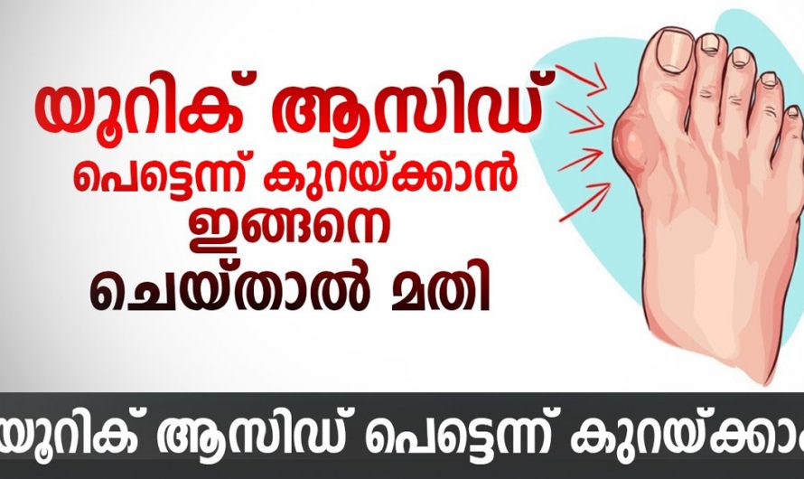 യൂറിക്കാസിഡ് മാറ്റാൻ ഇതിലും വലിയ എളുപ്പവഴി വേറെയില്ല. ഈ ഇൻഫോർമേഷൻ അറിയാതെ പോവല്ലേ. | Uric acid Health Malayalam