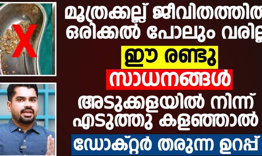 മൂത്രക്കല്ല് ജീവിതത്തിൽ ഒരിക്കൽ പോലും വരില്ല. ഈ രണ്ടു സാധനങ്ങൾ എടുത്തു മാറ്റിയാൽ മതി. | Remove Urinary Stones