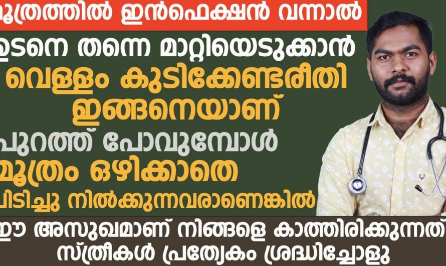 മൂത്രത്തിൽ ഉണ്ടാകുന്ന ഇൻഫെക്ഷൻ കുറയ്ക്കാൻ ഇതിലും എളുപ്പം മാർഗം വേറെയില്ല. ഇൻഫക്ഷൻ കുറയ്ക്കാൻ ഇതുപോലെ ചെയ്യൂ. | Urinary tract infection