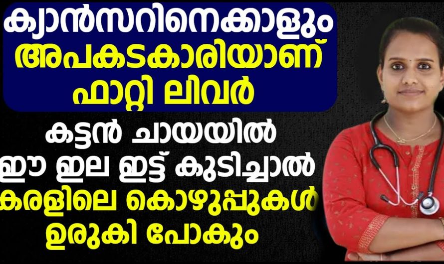 ഫാറ്റി ലിവർ ജീവിതത്തിൽ വരാതിരിക്കാൻ ഈ നാച്ചുറൽ ഒറ്റമൂലി ഉപയോഗിച്ചാൽ മതി. | Prevent Fatty liver