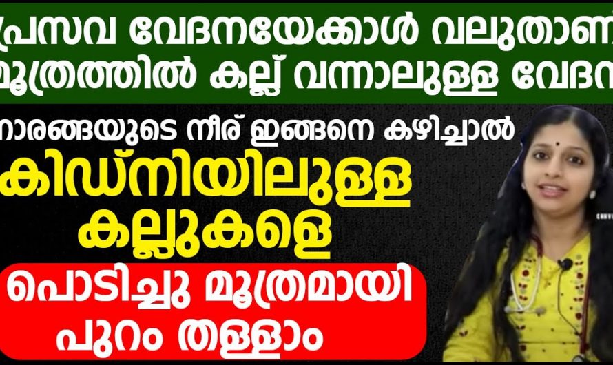 പ്രസവ വേദനയേക്കാൾ വലുതാണ് മൂത്രത്തിൽ കല്ല് വന്നാൽ ഉള്ള വേദന. ഉടനെ പരിഹാരം കാണാൻ ഇതുപോലെ ചെയ്താൽ മതി. | Prevent Kidney Stone