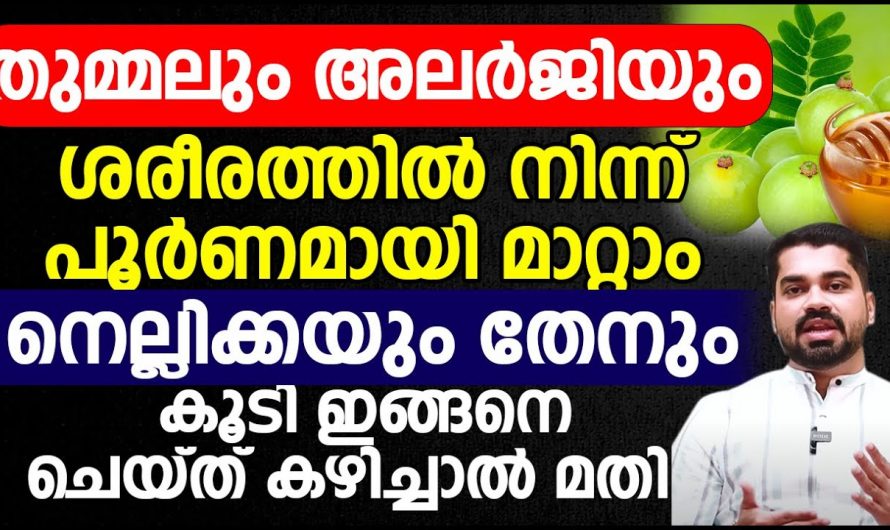 ഇടയ്ക്കിടയ്ക്ക് വരുന്ന തുമ്മലും അലർജിയും പിന്നീട് വരാത്ത രീതിയിൽ മാറ്റിയെടുക്കുന്നതിന് ഡോക്ടർ പറയുന്നത് കേൾക്കൂ. | Reduce Sneezing and allergies