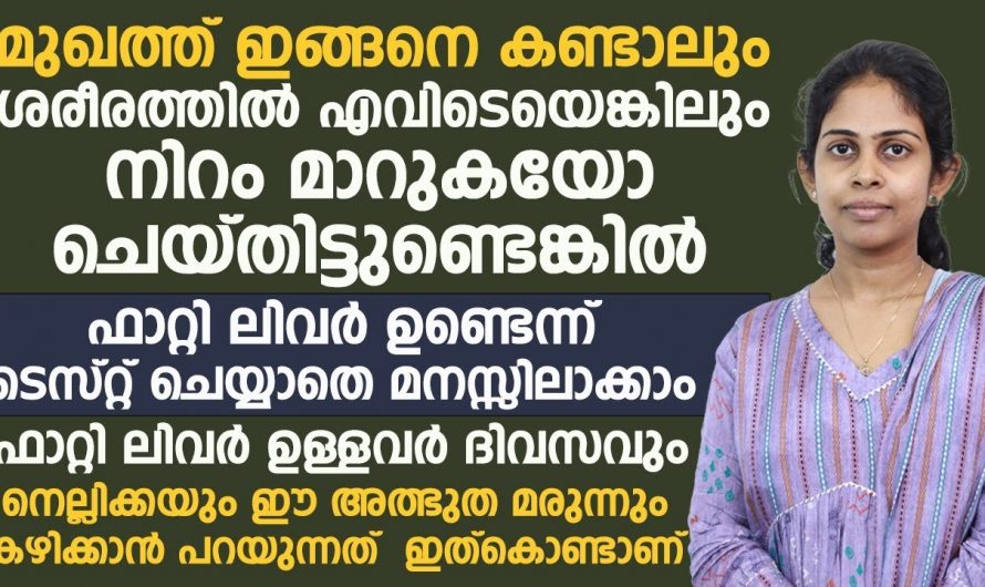 മുഖത്ത് ഇതുപോലെ കണ്ടാലും ശരീരത്തിൽ എവിടെയെങ്കിലും നിറം മാറിയാലും മനസ്സിലാക്കാം നിങ്ങൾക്ക് ഫാറ്റി ലിവർ ഉണ്ടെന്ന്. | important signs of fatty liver