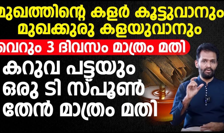 മുഖത്തിന്റെ കളർ കൂട്ടാനും മുഖക്കുരു കളയാനും വെറും മൂന്നുദിവസം മാത്രം മതി. | To get rid of acne Face