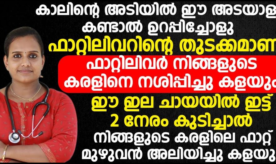 കാലിന്റെ അടിയിൽ ഈ അടയാളം കണ്ടാൽ ഉറപ്പിച്ചോളൂ ഫാറ്റി ലിവറിന്റെ തുടക്കമാണ്. | Symptoms Of Fatty Liver