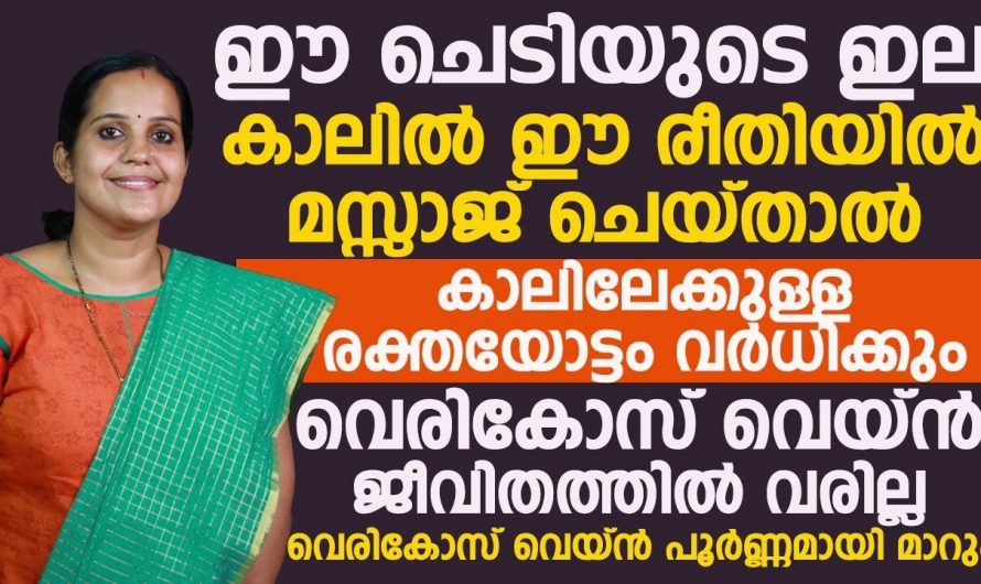 വീട്ടിലെ ഈ സാധനങ്ങൾ ഉപയോഗിച്ചു നോക്കൂ… വെരിക്കോസ് വെയിൻ എളുപ്പത്തിൽ മാറും..