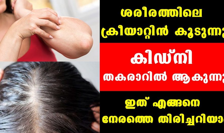 ക്രിയാറ്റിന്റെ അളവ് കൂടാതിരിക്കണോ?ഈ ഭക്ഷണങ്ങൾ കഴിച്ചാൽ മതി..