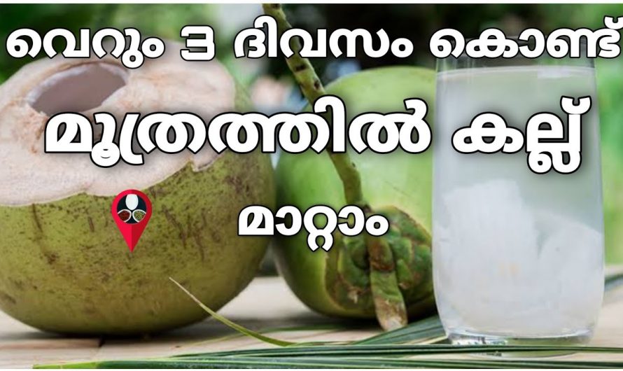 വൃക്കയിലെ കല്ല് അലിയിക്കാൻ… ഒരു അത്യുഗ്രൻ ഒറ്റമൂലി..100% ഉറപ്പ്