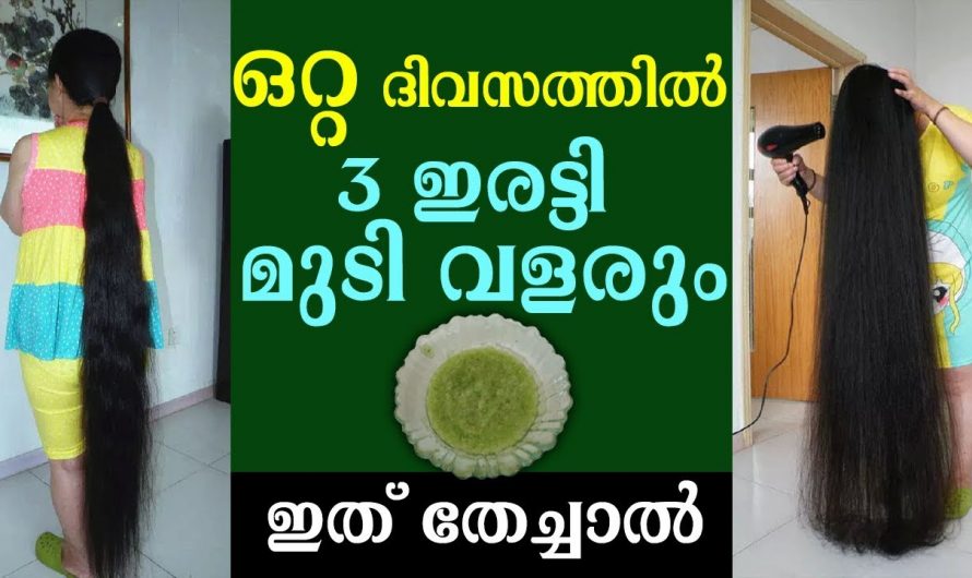 പ്രായഭേദമന്യേ ആർക്കും മുടി വളരും ഈ രണ്ട് ചേരുവകൾ ഉപയോഗിച്ചാൽ മതി