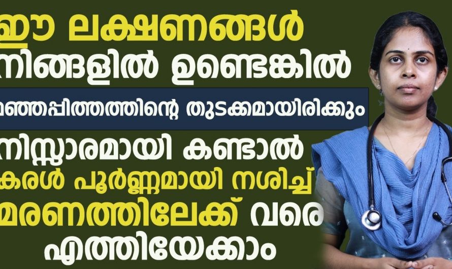 ഈ ലക്ഷണങ്ങൾ ഉണ്ടെങ്കിൽ അത് മഞ്ഞപ്പിത്തത്തിന്റെ തുടക്കമായിരിക്കാം. നിസാരമായി കണ്ടാൽ കരൾ നശിച്ചു പോകും. | jaundice beginning symptoms