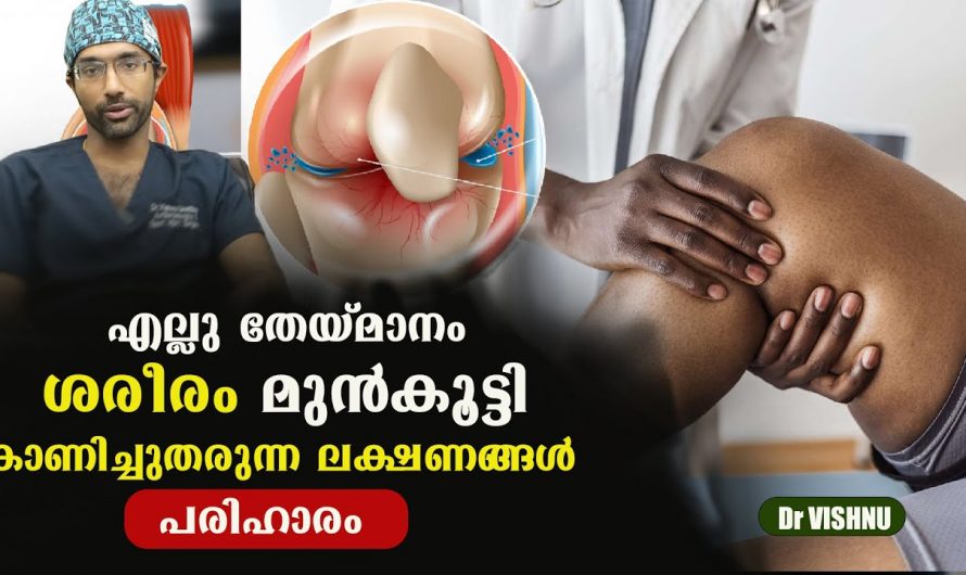 എല്ല് തേയ്മാനം സംഭവിക്കുന്നതിനു മുൻപ് ശരീരം കാണിച്ചു തരുന്ന ലക്ഷണങ്ങൾ. | Bone wear symptoms