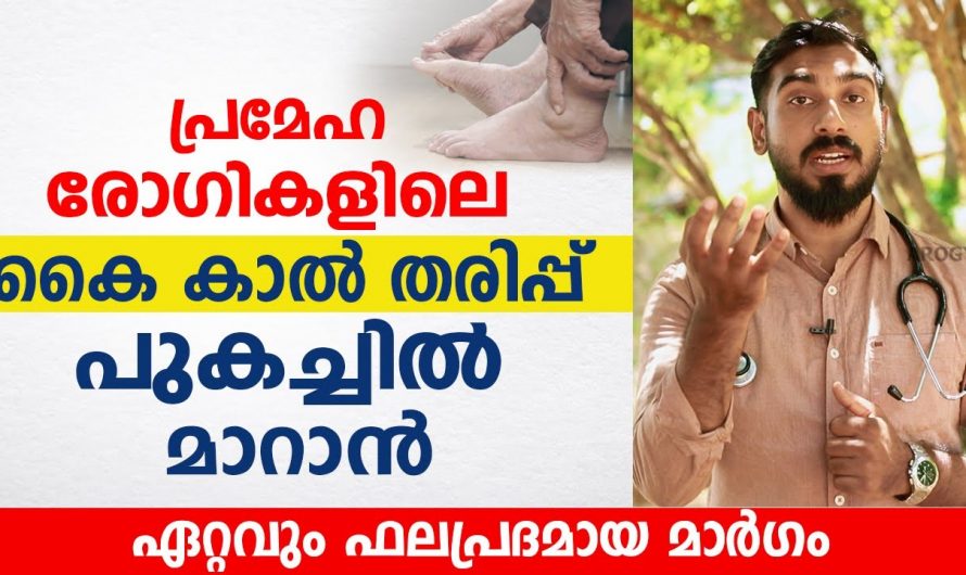 പ്രമേഹ രോഗികളിൽ മാത്രം ഉണ്ടാകുന്ന കൈകാൽ തരിപ്പ് പുകച്ചിൽ മാറാൻ ഇതുപോലെ ചെയ്യൂ. | How to get rid of swollen feet naturally