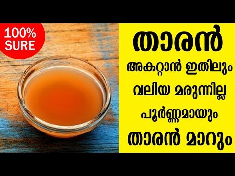 മുടിയിലെ താരൻ ഇനിയൊരു പ്രശ്നമാവില്ല ഇങ്ങനെ ഒന്ന് ചെയ്തു നോക്കൂ..