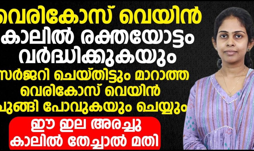 ഈ രോഗത്തിന് ഇനി ചികിത്സ വേണ്ട കരുതൽ മതി…