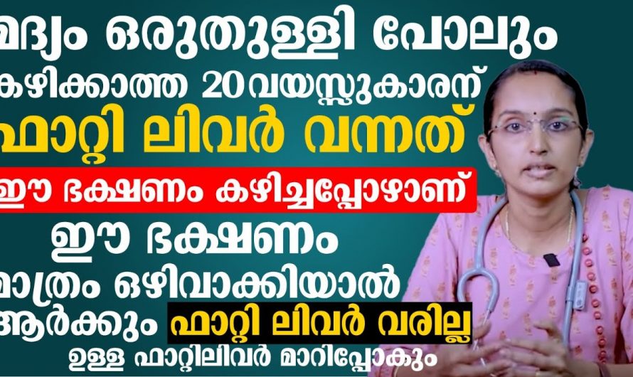 ഈ ഭക്ഷണങ്ങൾ കഴിച്ചാൽ ഉറപ്പായും നിങ്ങൾക്ക് ഫാറ്റി ലിവർ ഉണ്ടാവും.. സൂക്ഷിച്ചാൽ ദുഃഖിക്കേണ്ട