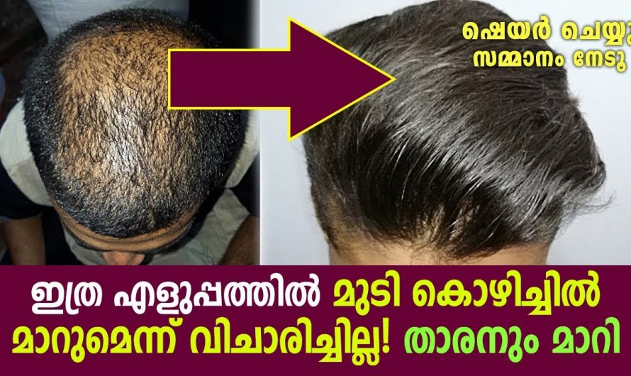 ഇത് അല്പം മുടിയിൽ തേച്ചാൽ മതി… മുടി തഴച്ചു വളരും…