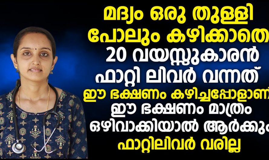 ഈ ഭക്ഷണങ്ങൾ കഴിക്കുന്നവരിൽ ഉറപ്പായും ഫാറ്റി ലീവ് ഉണ്ടാകും…