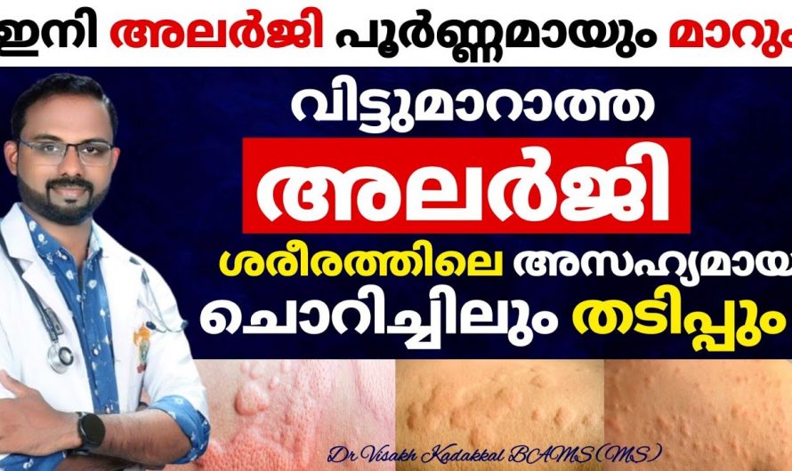 അലർജി നിസ്സാരക്കാരനല്ല.. ഈ കാര്യങ്ങൾ ശ്രദ്ധിച്ചാൽ അകറ്റി നിർത്താൻ ആവും..