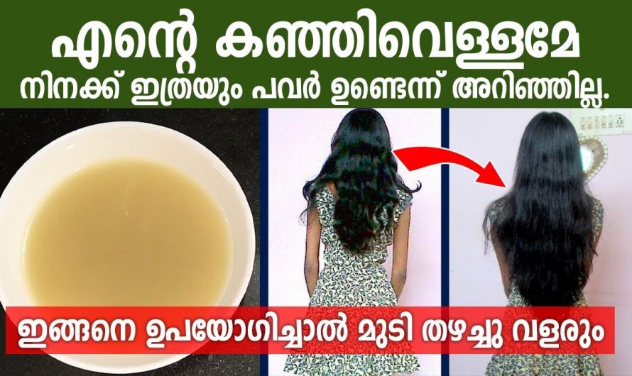 മുടി വളരാൻ ആരും പറഞ്ഞു തരാത്ത ഒരു രീതി.. രണ്ട് ചേരുവകൾ മാത്രം മതി..