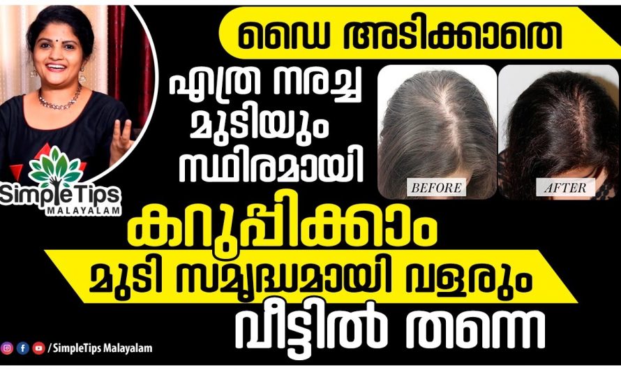 എത്ര നരച്ച മുടിയും കറുപ്പിക്കാം.. ഒരു കിടിലൻ ഡൈ