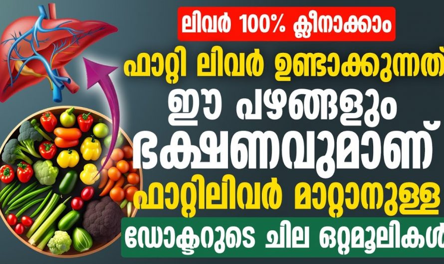 ഫാറ്റി ലിവർ വരാതിരിക്കാൻ നിങ്ങൾ ചെയ്യേണ്ടത് ഇതാണ്, ശ്രദ്ധിച്ചില്ലെങ്കിൽ ഗുരുതരം ആവും…