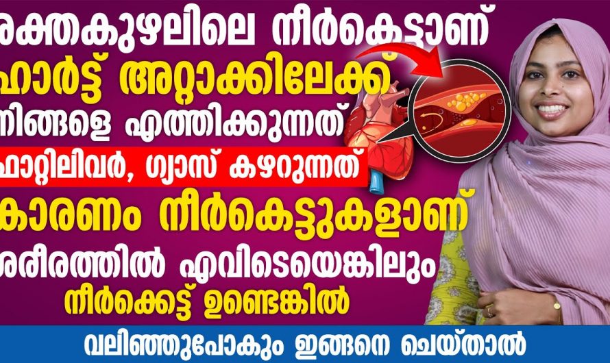 വിട്ടുമാറാത്ത തലവേദനയുടെ കാരണം ഇതാണ്, നീർക്കെട്ട് വരാതിരിക്കാൻ ഈ കാര്യങ്ങൾ ശ്രദ്ധിക്കുക…