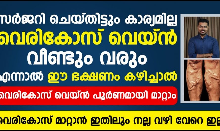 കാലുകളിൽ ഉണ്ടാകുന്ന ഈ പ്രശ്നം നിസ്സാരക്കാരനല്ല.. ഇവ കാലിൻറെ ചലനശേഷി വരെ നഷ്ടപ്പെടുത്തും..