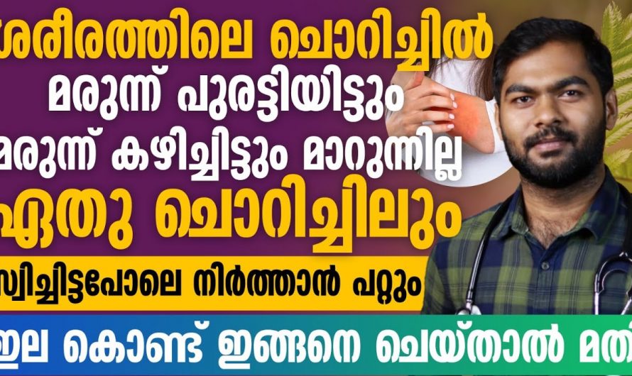 പേടിയോടെ മാത്രം നോക്കി കാണേണ്ട ഒരു ത്വക്ക് രോഗം.., ചികിത്സ വൈകിയാൽ ഇത് ഗുരുതരമാകും…