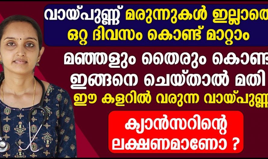 വായ്പുണ്ണിനോടൊപ്പം ഈ ലക്ഷണം കൂടി ഉണ്ടെങ്കിൽ ഉടൻതന്നെ ചികിത്സ ഉറപ്പാക്കൂ അല്ലെങ്കിൽ ഗുരുതരം ആവും….