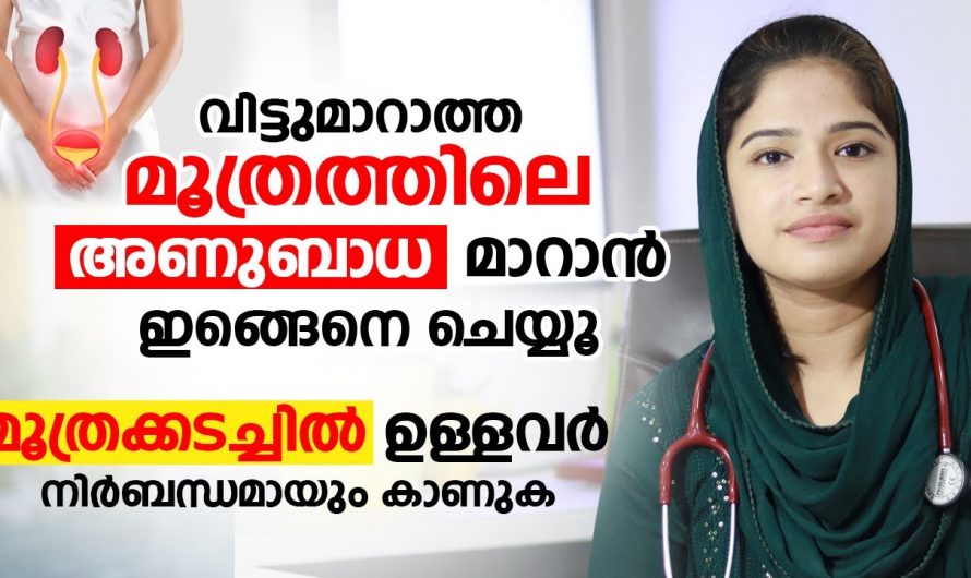 യൂറിനറി ഇൻഫെക്ഷൻ വരാതിരിക്കാനായി സ്ത്രീകൾ ശ്രദ്ധിക്കേണ്ട ചില കാര്യങ്ങൾ…