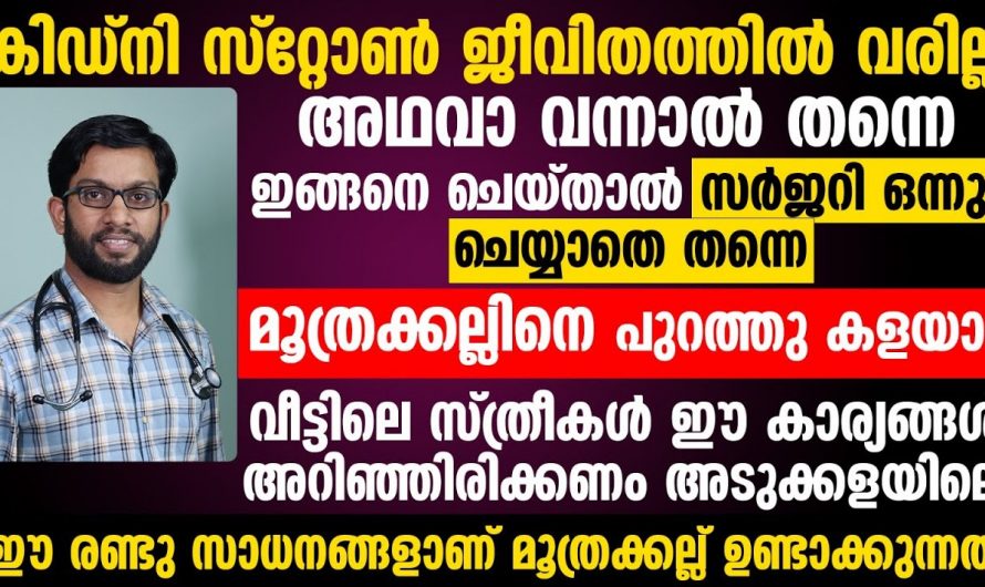 കിഡ്നി സ്റ്റോൺ വരാതിരിക്കാൻ ഈ കാര്യങ്ങൾ അറിഞ്ഞിരിക്കണം, ഉപകാരപ്രദമായ അറിവ്…