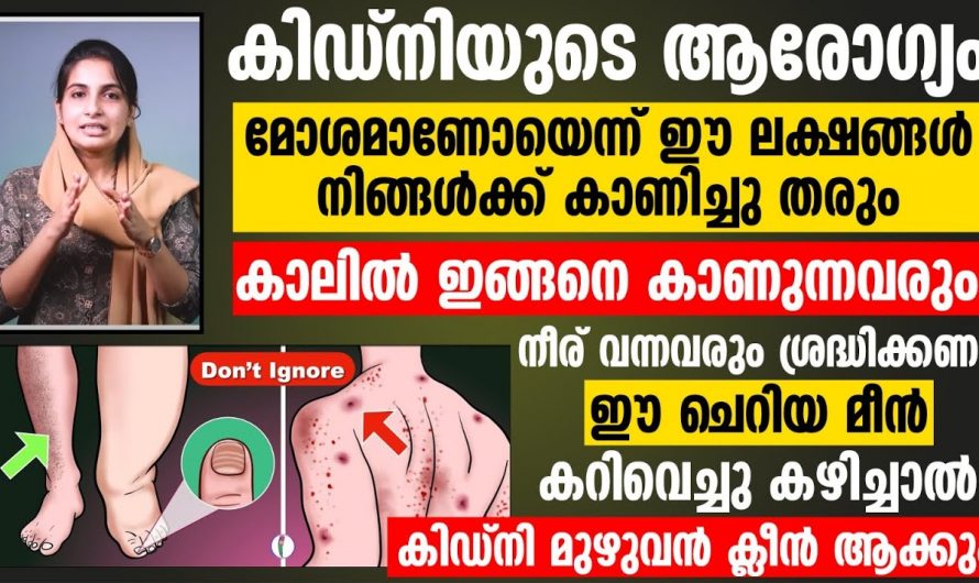 ഈ അടയാളങ്ങൾ നിങ്ങൾക്ക് ഉണ്ടെങ്കിൽ സൂക്ഷിച്ചോളൂ നിങ്ങളുടെ വൃക്കയും തകരാറിൽ ആകാൻ പോകുന്നു…