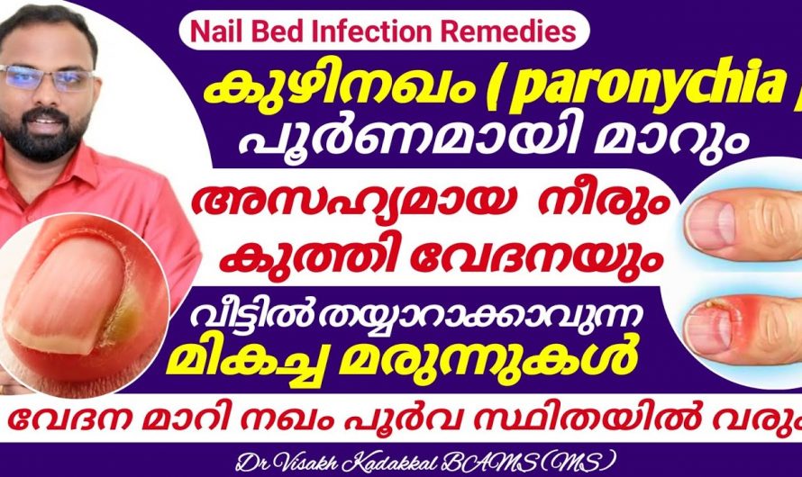 കുഴിനഖം മാറ്റാം വീട്ടിൽ തന്നെ, ആരും പറഞ്ഞു തരാത്ത ഒരു കിടിലൻ ടിപ്പ്…