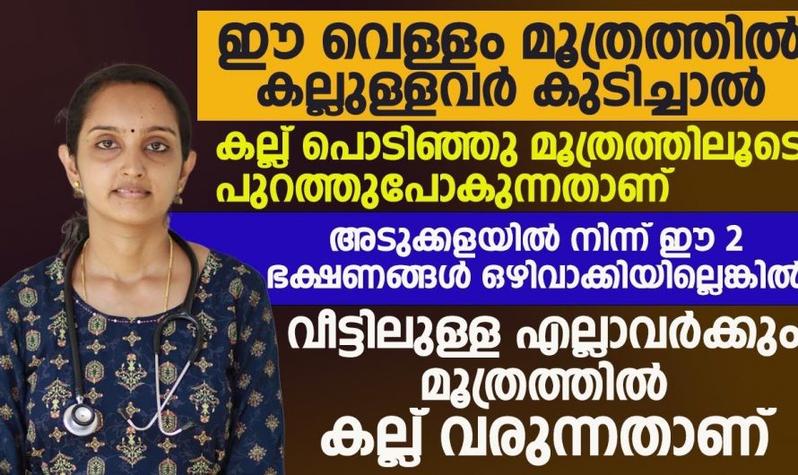 കിഡ്നി സ്റ്റോൺ വരാതിരിക്കാൻ ഈ കാര്യങ്ങൾ ശ്രദ്ധിക്കൂ, സ്ത്രീകൾ ഉറപ്പായും ഇത് അറിഞ്ഞിരിക്കണം…