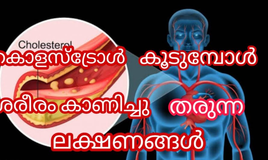 മരുന്ന് കഴിക്കാതെ കൊളസ്ട്രോൾ കുറയ്ക്കാൻ ഈ ഭക്ഷണങ്ങൾ പൂർണമായും ഒഴിവാക്കിയാൽ മതി…