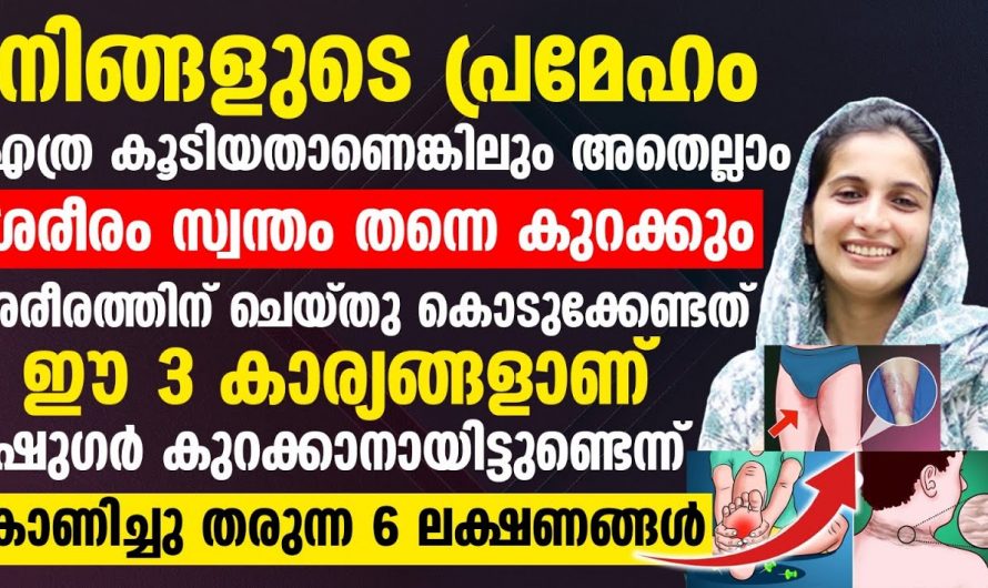 പ്രമേഹം വരാതിരിക്കാനായി ചെയ്യേണ്ടത് ഇതാണ്, ഈ രീതി പിന്തുടരുക…