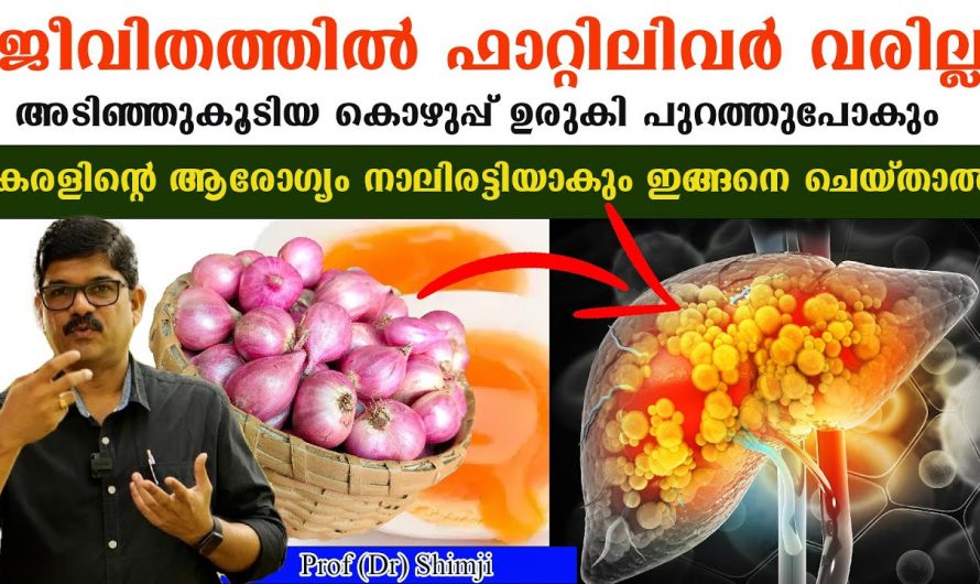 ഫാറ്റി ലിവർ നിസാരക്കാരനല്ല! തുടക്കത്തിലെ ഈ ലക്ഷണങ്ങൾ തിരിച്ചറിയൂ…